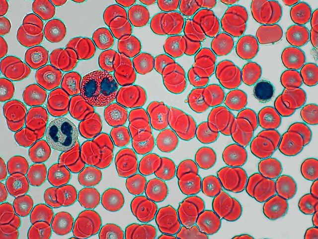 Hematoxylin-eosin stained blood cells