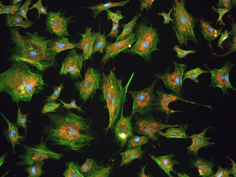 JENOPTIK SYIONS® projection - the perfect image Multifluorescence